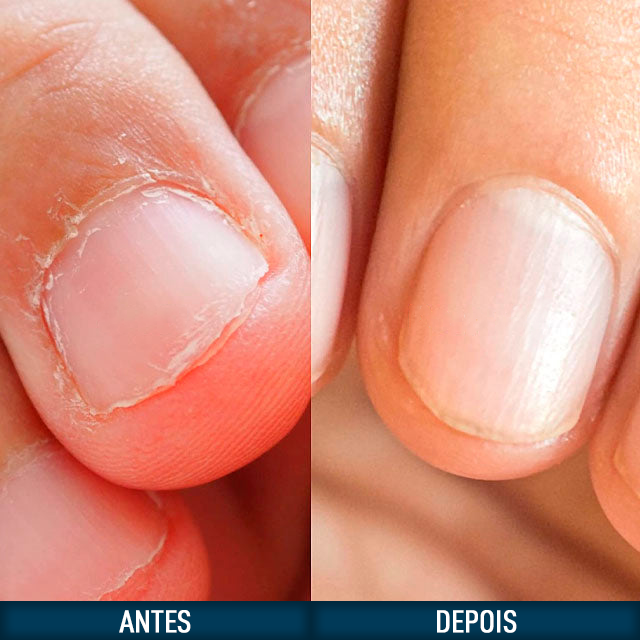 Verniz para Evitar Roer as Unhas com Sabor Amargo