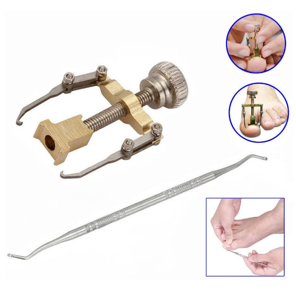 corrector-de-unas-encarnadas-ortoprime