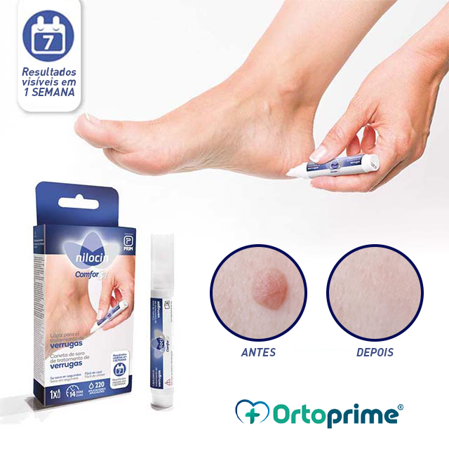 Lápis para Tratamento de Verrugas no Corpo - Queratolítico