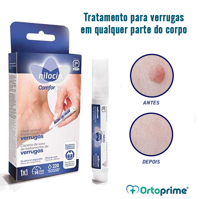 Lápis para Tratamento de Verrugas no Corpo - Queratolítico