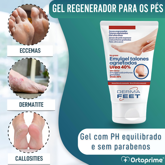Gel para Calcanhares Rachados | Concentração de Ureia 40%