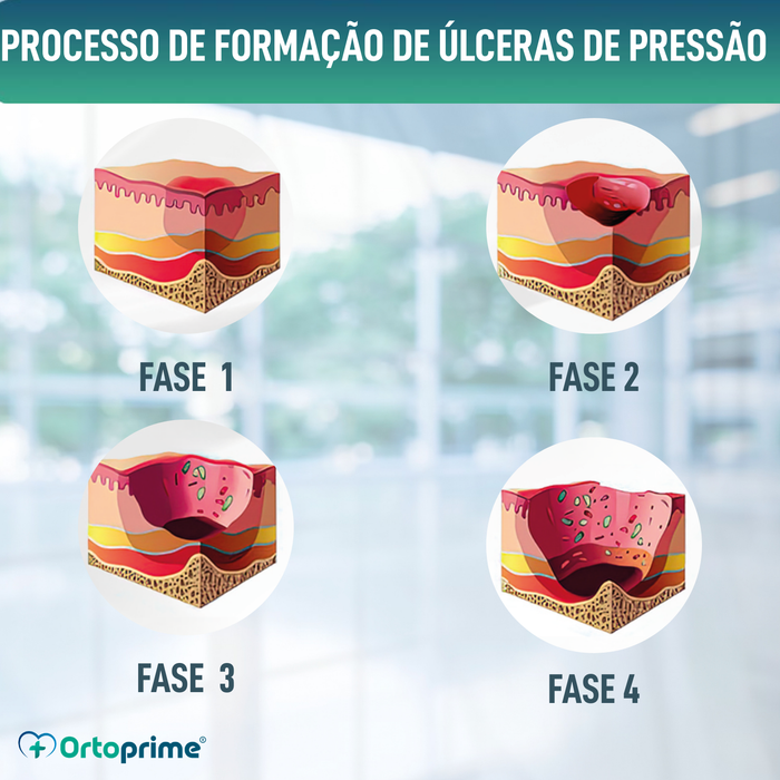Almofada Viscoelástica Anti-Escaras para Cóccix 60kg/m3